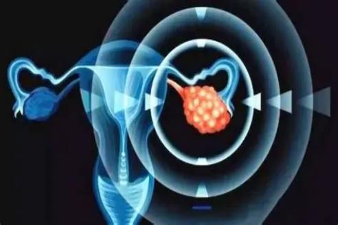 33岁卵巢早衰患者接受干细胞治疗6个月后奇迹自然怀孕！