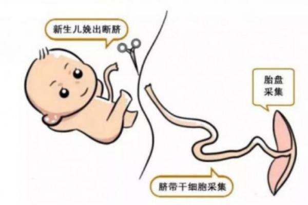存脐带还是存胎盘？区别一次讲清