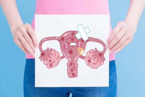 卵巢早衰（POF）是什么？这 3 个典型表现要留意