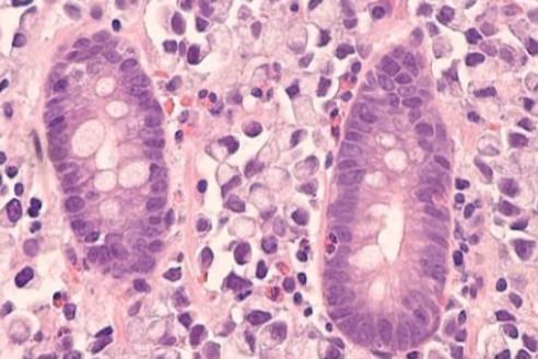 干细胞 “归巢” 是什么意思？它怎么找到受损的卵巢？